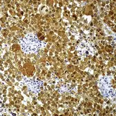 Anti-S100 antibody [4C4.9] used in IHC (Paraffin sections) (IHC-P). GTX24066